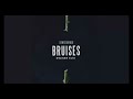 Lewis Capaldi - Bruises - SWISER Edit