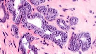 OTLS-3 20X prostate 33E small glands CLAHE test 2