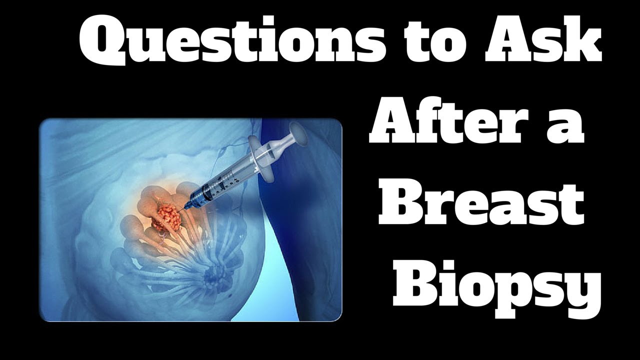 Questions To Ask After A Breast Biopsy - YouTube