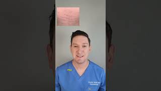 Dermatologist Explains Stretch Marks: What causes them & how to treat at home! #stretchmarks