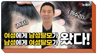 남성형탈모, 여성형탈모의 정수리탈모 치료법! (탈모약,여유증,모발이식)ㅣ뉴헤어