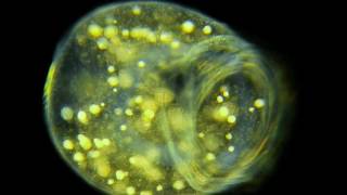 Amazing Microscopic HD Video! Vorticella. Free-Swimming. 100x to 600x