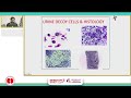 BK virus nephropathy in renal transplantation and the effect of intravenous immunoglobulin -Dr.Kiran