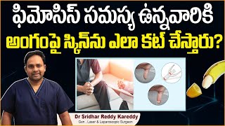 ఫిమోసిస్ కు సున్తీ | Stapler Circumcision Procedure in Telugu | Phimosis | Treatment Range Hospitals