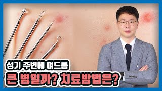 [맨즈업 비뇨기과  수원점] 성기 주변 피부 트러블 큰병일까?