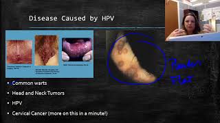 Human Papillomavirus HPV