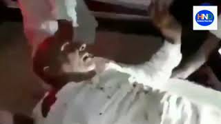 Viral Video : गोली लगने पर भी stretcher पर beedi पीता रहा शख्स