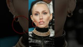 Ozempic Face: See How Weight Loss Transforms Celebrity Faces!