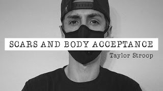 SCARS AND BODY ACCEPTANCE | Taylor Stroop