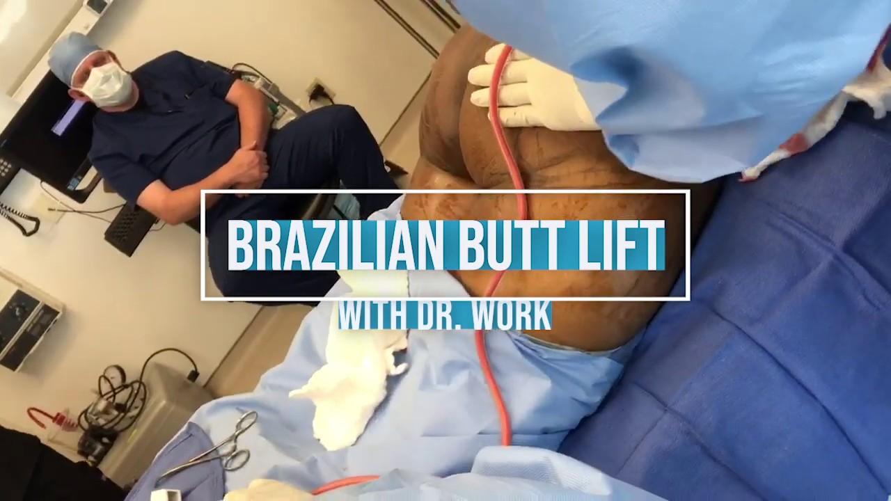 Brazilian Butt Lift With Dr. Work - YouTube