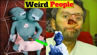 दुनिया के 3 अजीबोगरीब लोग || Weird People || 😮😮 | amazing facts || 😦