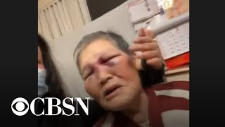 Elderly Asian woman attacked in San Francisco fights back