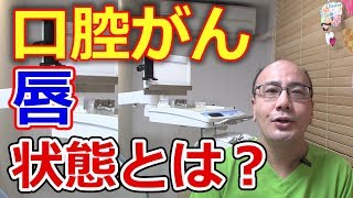 唇にできる口腔がんの状態とは？【千葉市中央区の歯医者】