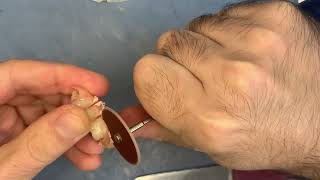 Починка сломанного кламмера нейлонового протеза.Мой метод. Repairing a broken clasp flexible denture