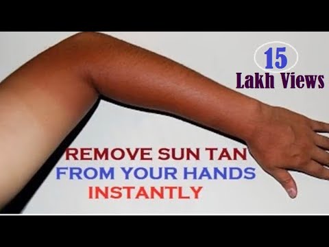 How to Remove Suntan from Your Hands Quickly - Instant Results How to Remove Suntan from Your Hands Quickly - Instant Results