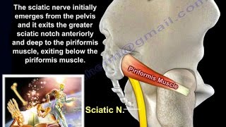 Sciatica,disc herniation and piriformis syndrome - Everything You Need To Know - Dr. Nabil Ebraheim