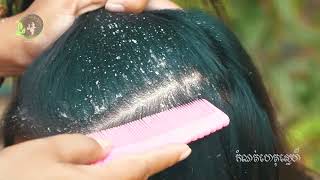 She scratch dandruff look so interested 2014