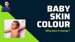 Baby Skin Colour | Why does it Change ?