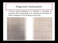 Early Postoperative Arrhythmias after pediatric cardiac surgery Dr. Osama Abdelaziz,