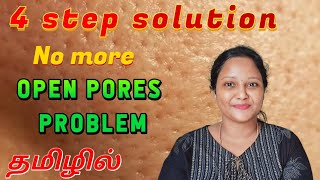 Open pores | large pores on face | என்ன செய்யலாம் ? | 4 step skincare routine #openpores