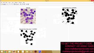 Detection and counting of blood cells using image segmentation A review
