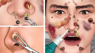 ASMR Treatment for Allergic Nose Piercings, Deep Cleansing Treatment