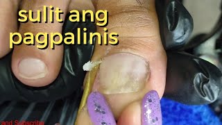 Vlog 566|Dry Skin/Ingrown Removal| PEDICURE 466