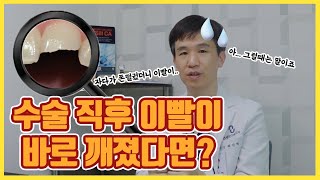 임플란트 수술후 충격은 어떤 영향을 끼치나요?!