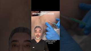 Say Goodbye to Sweat Stains and Underarm Sweating with Botox