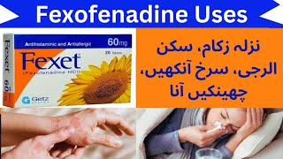 fexet 60 mg tablet | fexet tablet uses in urdu | fexet tablet uses | fexet 60 mg