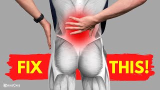 How to Fix Lower Back Strain Pain in 30 SECONDS