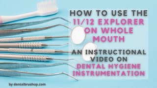 How to Use the 11/12 Explorer on Whole Mouth