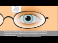 Cylinder in Prescription Glasses. Astigmatism Correction.