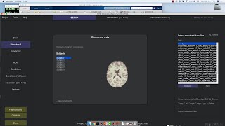 OSU Workshop, Part 4: The CONN Toolbox
