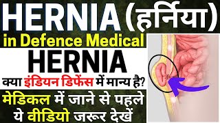 क्या इंडियन डिफेंस में हर्निया मान्य है? | 𝐇𝐞𝐫𝐧𝐢𝐚 Medical Test | Indian Defence 𝐇𝐞𝐫𝐧𝐢𝐚 Medical