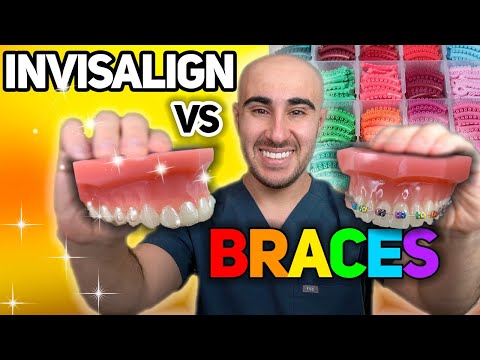 Is Invisalign really better than braces?