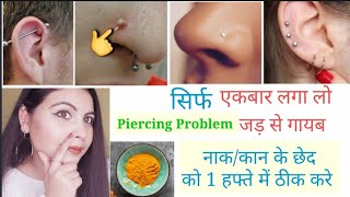 Nose Piercing/Ear Piercing को एक हफ्ते में ठीक करे l Piercing bumps/Yellow/white pus से कैसे बचे l