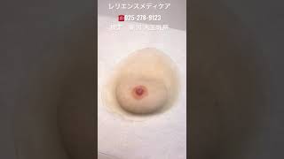 済生会三条病院患者様 乳がん再建しないから痛くない装着式人工乳房