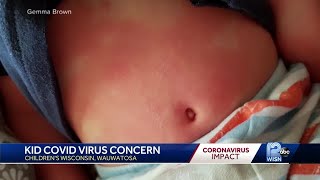 Children's Wisconsin doctors investigate mystery illness with possible link to COVID-19
