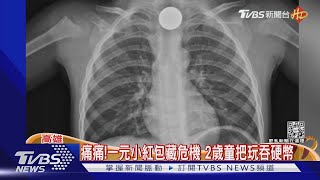 指著胸部喊痛痛! 一元小紅包藏危機 2歲男童把玩吞硬幣｜TVBS新聞