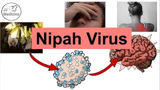 Nipah Virus: A Deadly Zoonotic Infection You’ve Probably Never Heard Of