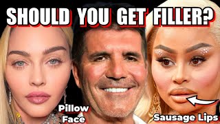 Don't get Fillers Until You Watch This!- Do Fillers Eventually Migrate & Cause Pillow Face?