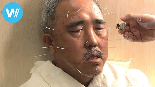 Qi - The Art of Traditional Chinese Medicine (Full Documentary)