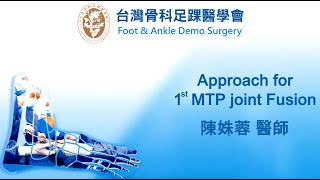 【Approach for 1st MTP joint fusion】Introduce by 陳姝蓉醫師.