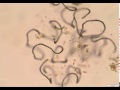 Protozoa feeding on a decaying colony of Anabaena cyanobacteria