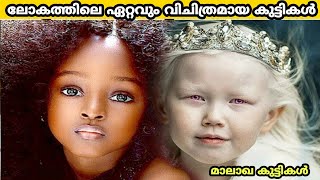 ലോകത്തിലെ ഏറ്റവും വിചിത്രമായ കുട്ടികൾ /The Most Unusual Child's In The World/part3/top10malayalam