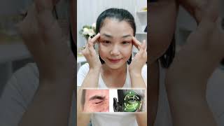 แก้ตีนกา หางตาเป็นริ้ว ยิ้มทีหางตายับ ด้วยมือเปล่า Remedies for Crow's feet , Eye wrinkles, at home