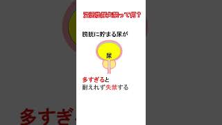 溢流性尿失禁ってなに？#必修 #国試対策