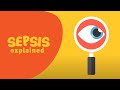 Sepsis explained: what is sepsis, why is sepsis so serious & what to do if you think you have sepsis