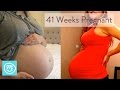 Download 41 Weeks Pregnant: What To Expect - Channel Mum In Mp4 3Gp Full HD Video